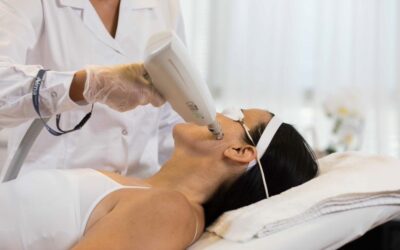 Laser Skin Treatments on the Costa del Sol