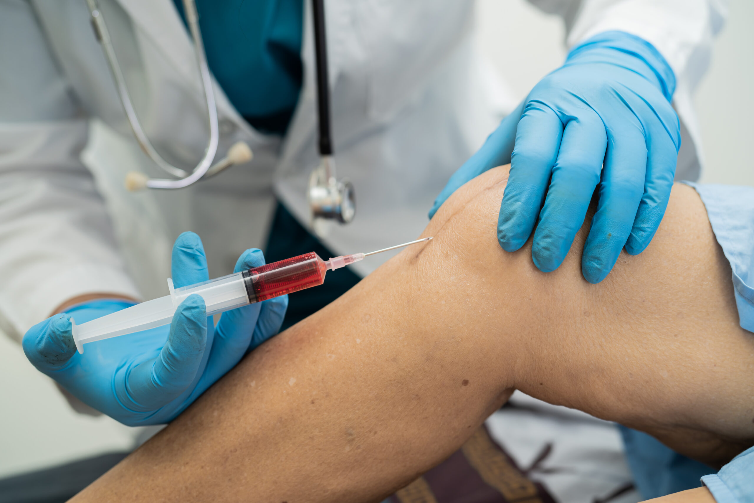Are Platelet-rich plasma (PRP) injections right for you?